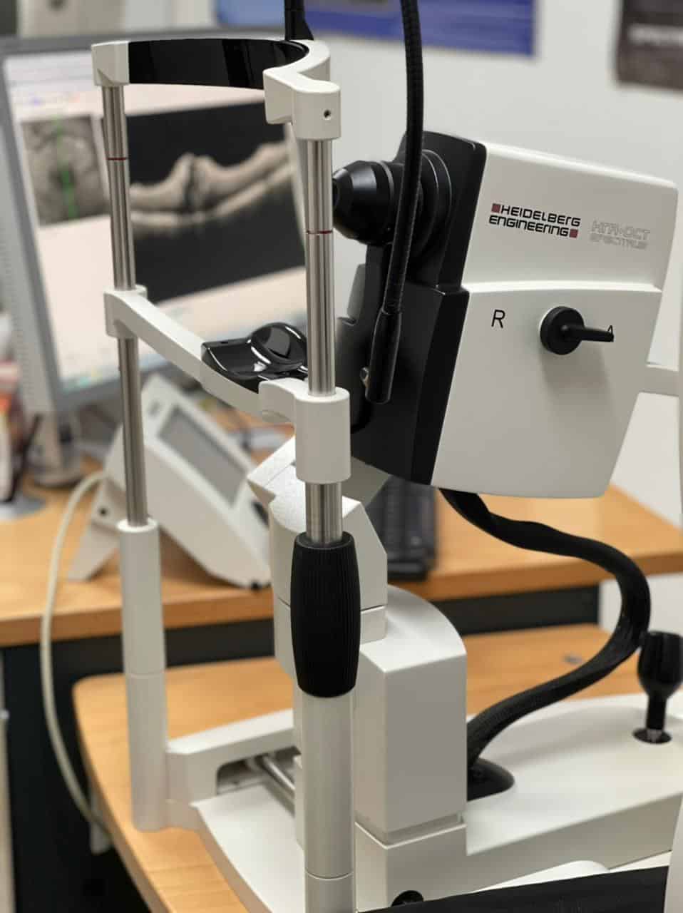 Angiografia Fluoresceinica