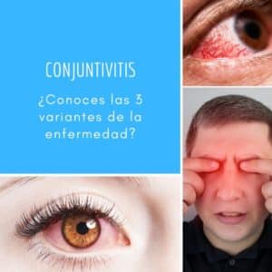 conjutivitis