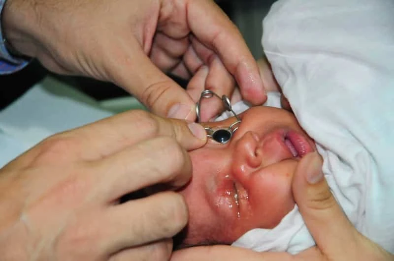 Evaluación ocular de un bebé, fotografía de la página institucional de Labor Social de Dr. Asilis